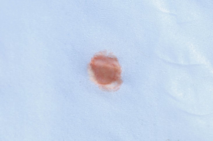 Latex séché sur un mouchoir montrant une couleur rouge typique